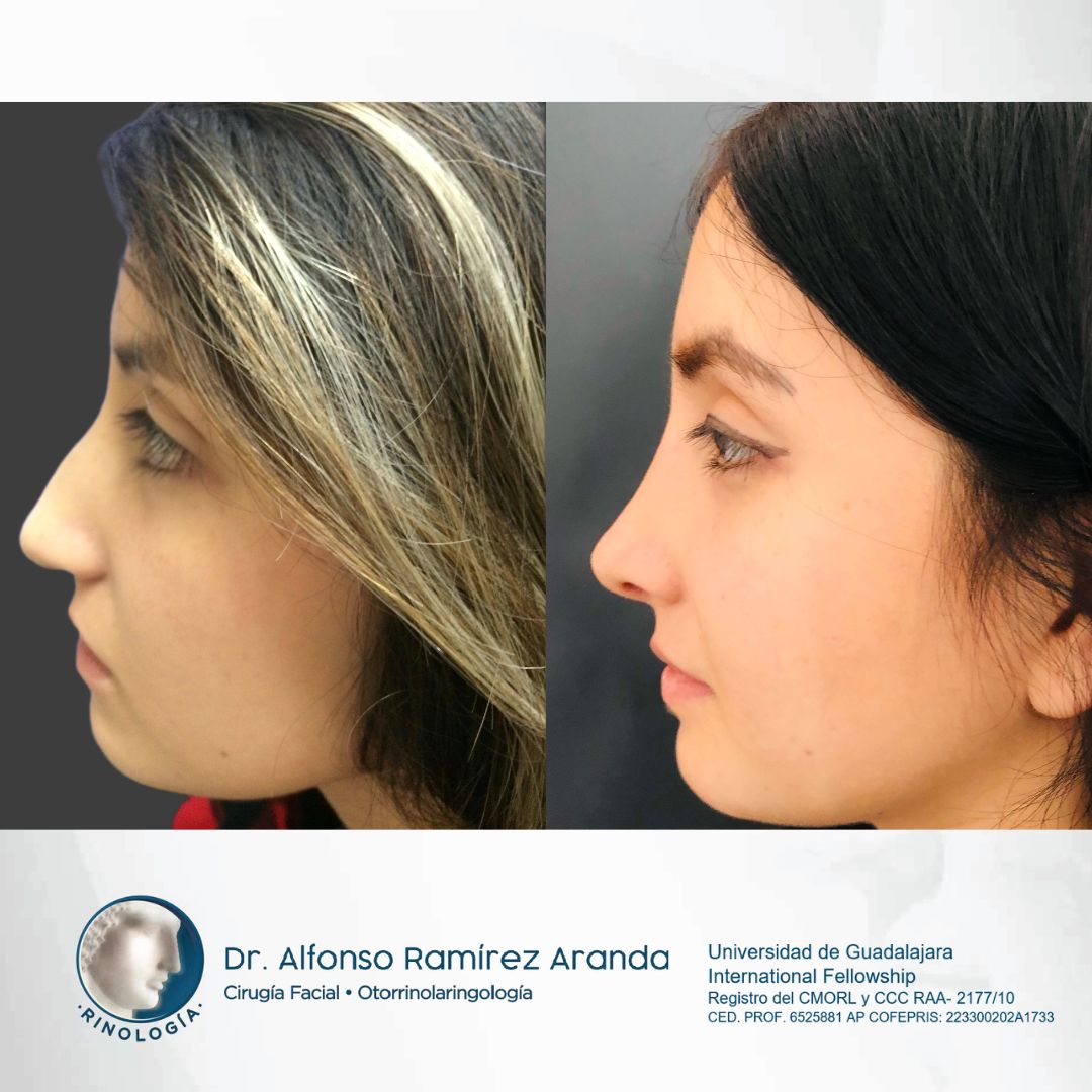 Alfonso Ramírez Aranda-31