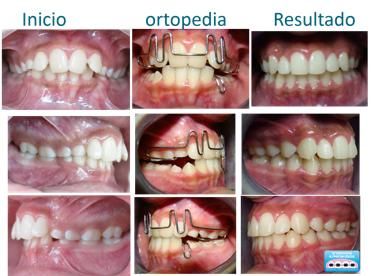 Mireya Quiroga Zamora-3