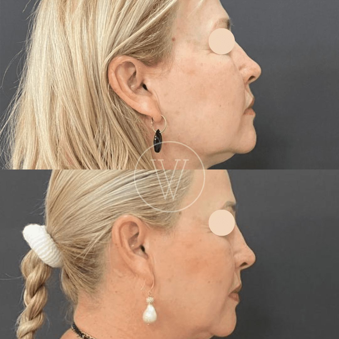 Stella Villarreal Garza-0