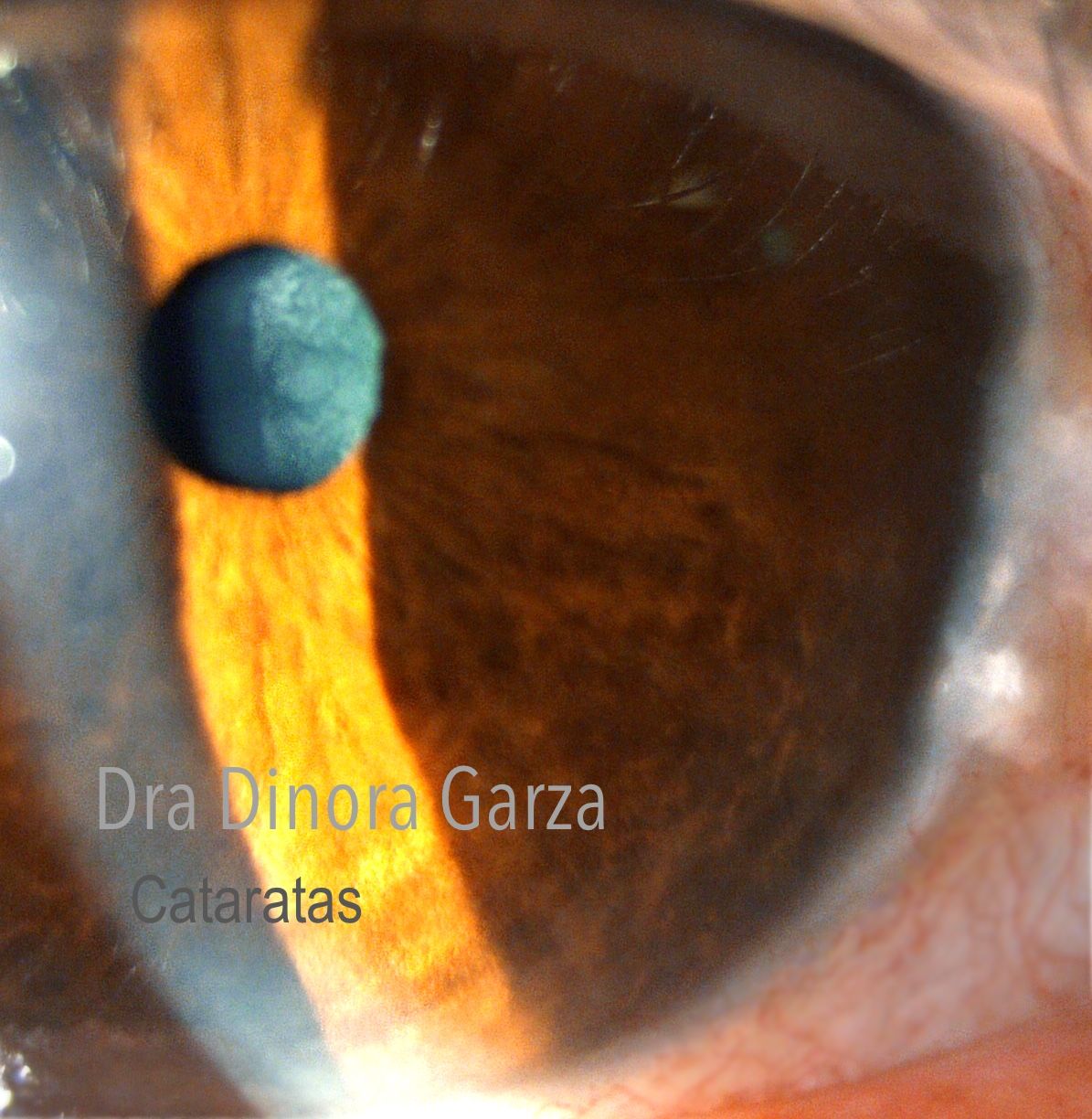 Dinora Garza Leal-31