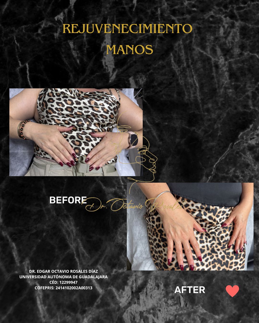 Edgar Octavio Rosales Diaz-27