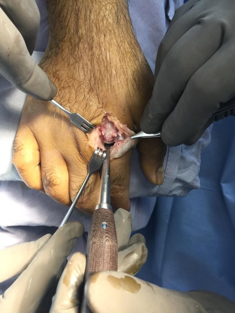 Victor Adrian López López-5