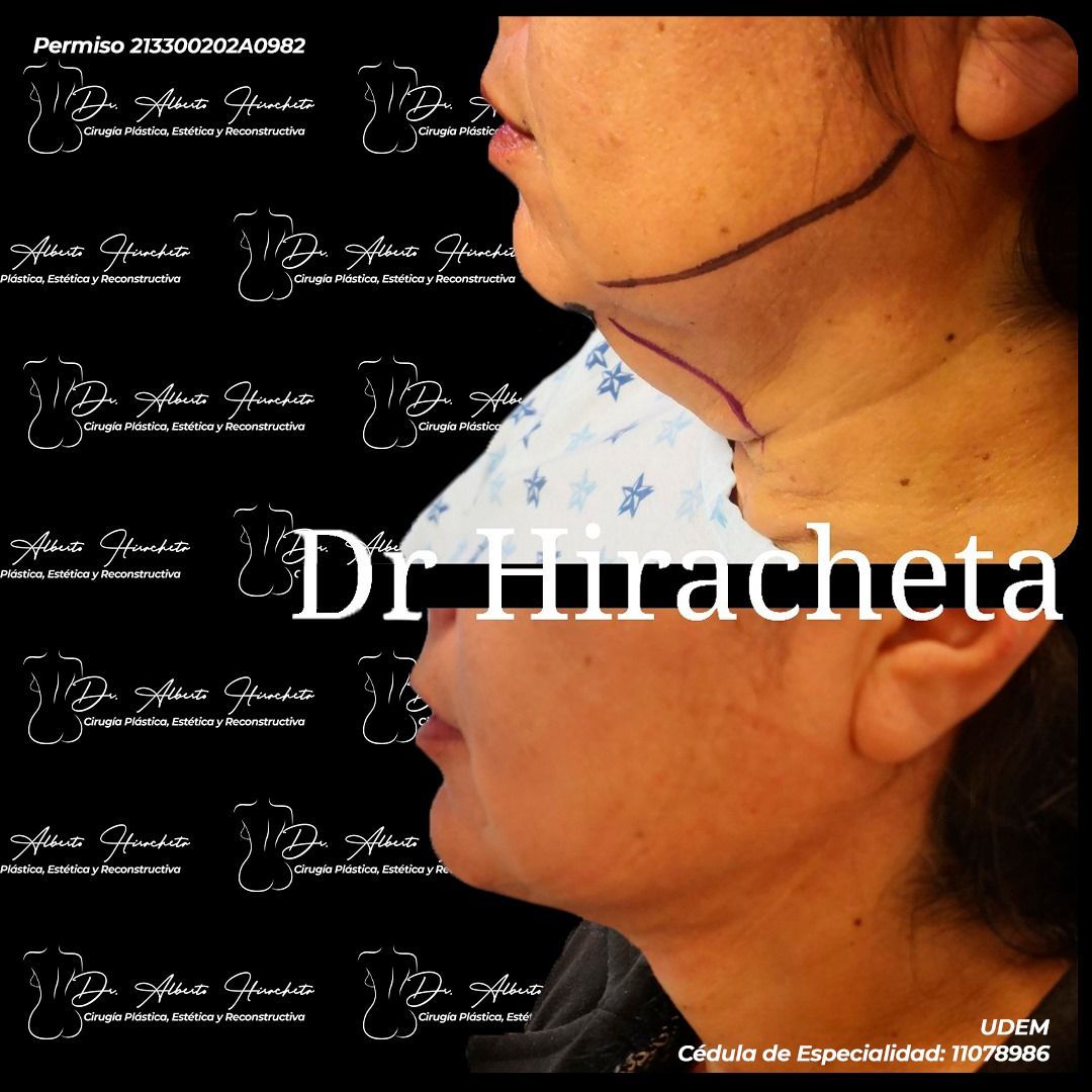 Alberto Hiracheta Torres-19