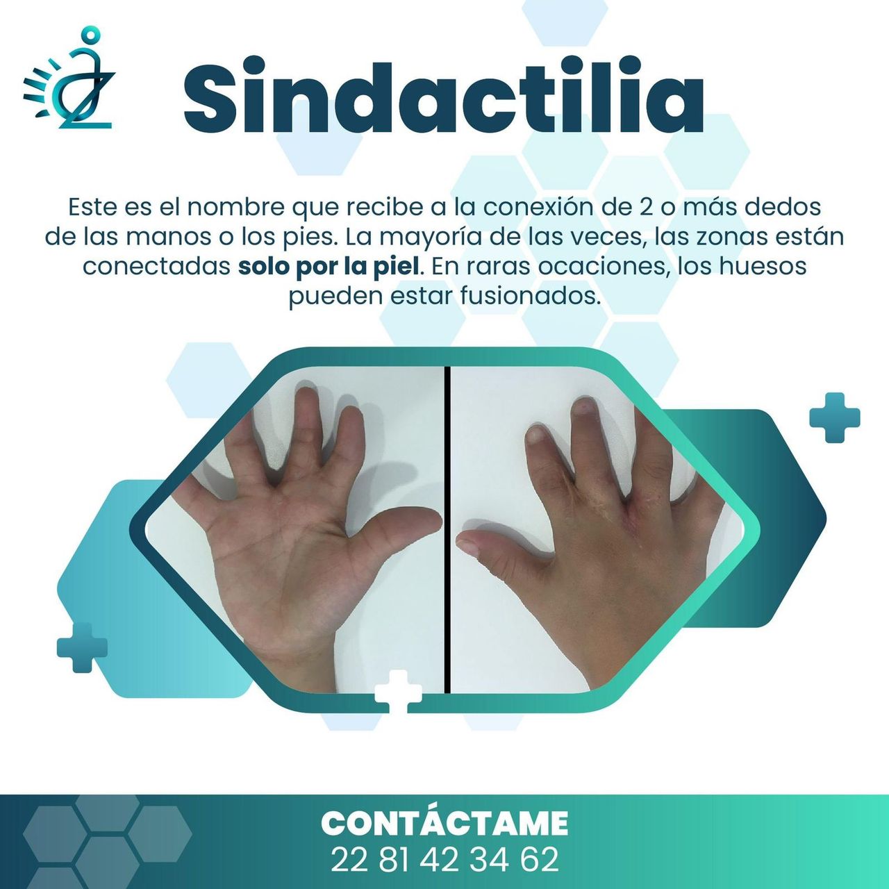 Aulio Cesar Ibarra Zavala-12