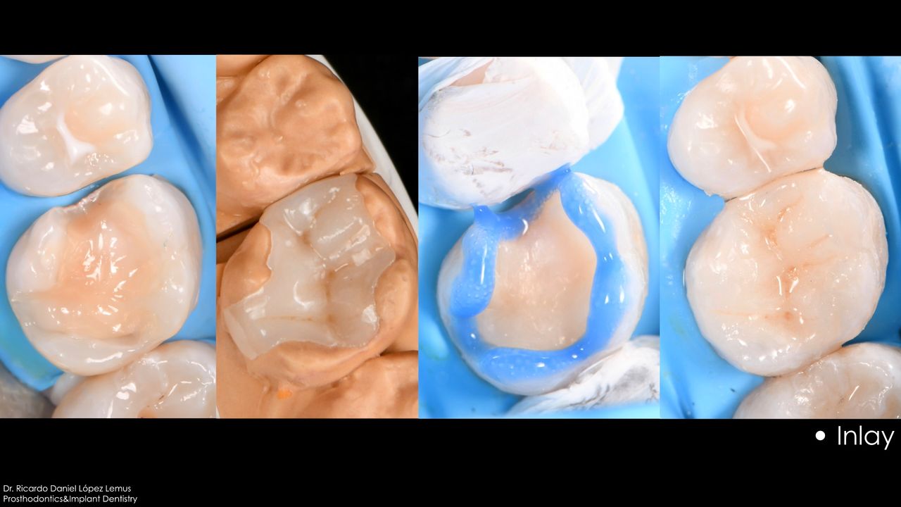 Ricardo López Lemus-35