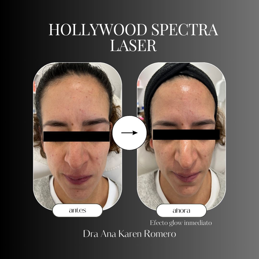 Ana Karen Romero Guzmán-5