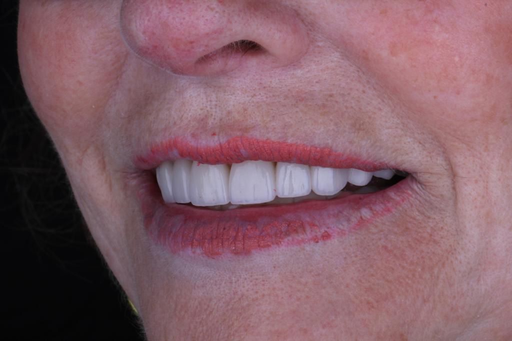 Josué Márquez Gómez-55