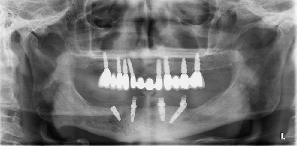 Sergio Cortes Aroche-6