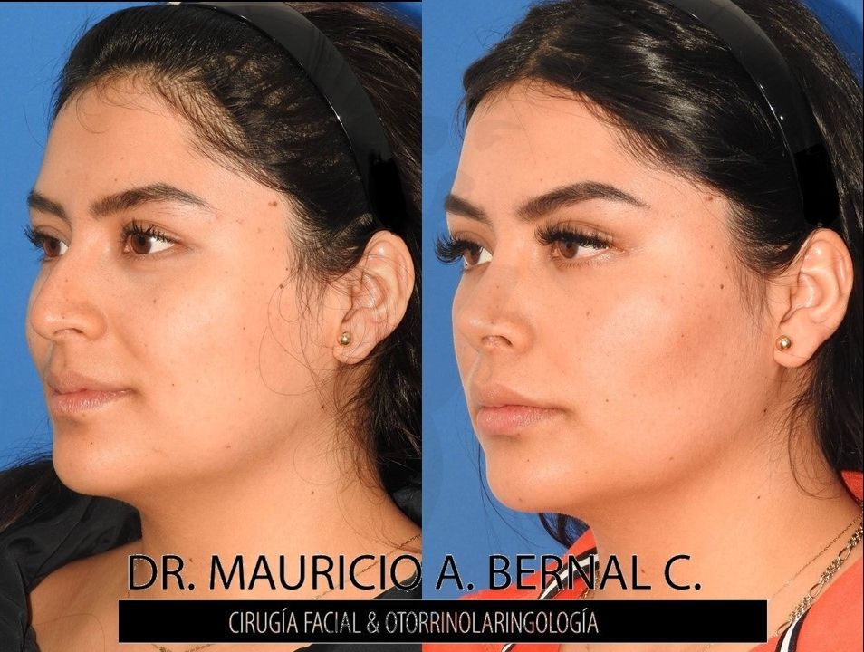 Mauricio Alejandro Bernal Carreon-18