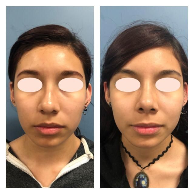 Carola Berenice Curiel Davalos-37