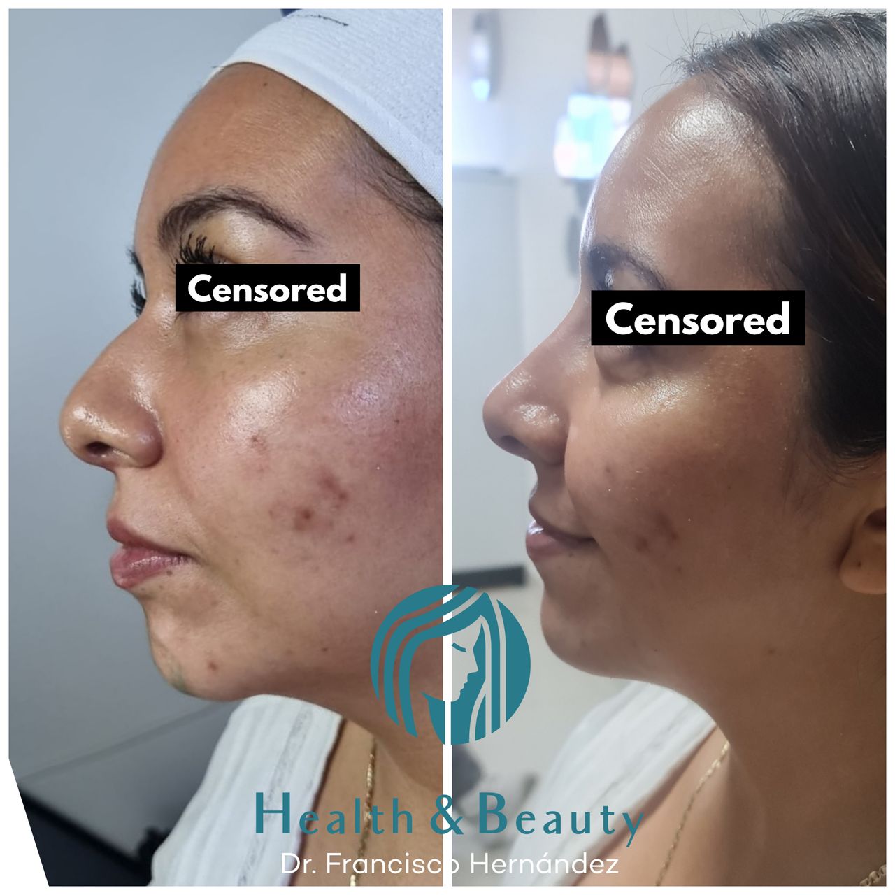 Francisco Hernández Gómez Crespo-100