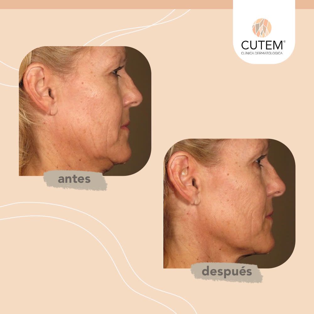 Fernando Martinez Gutierrez-11