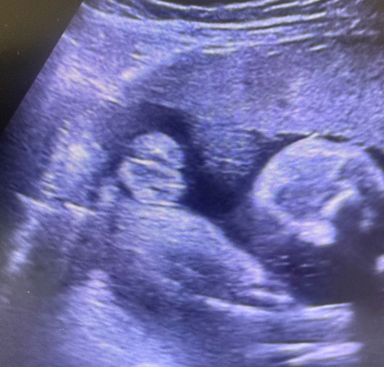 Mauricio Polanco Lepe-2