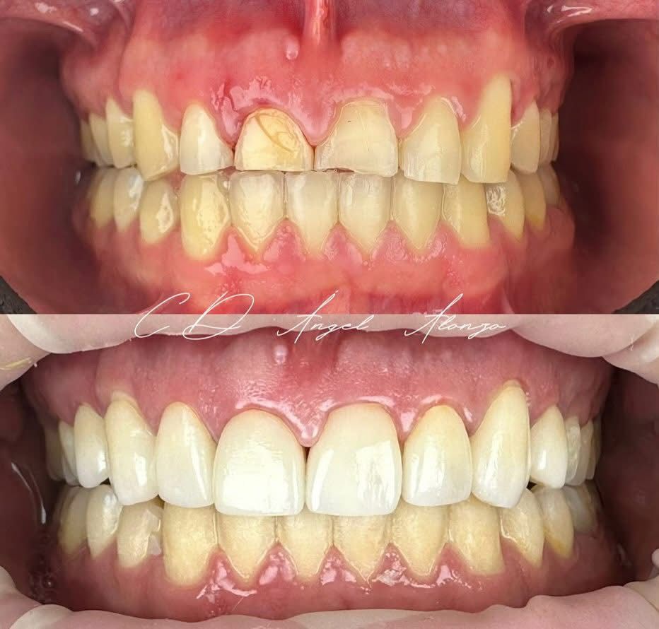 Martha Alicia Ceniceros Betancourt-6