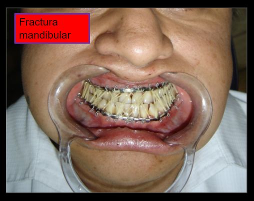 Diana Araceli Dávila Hernández-33