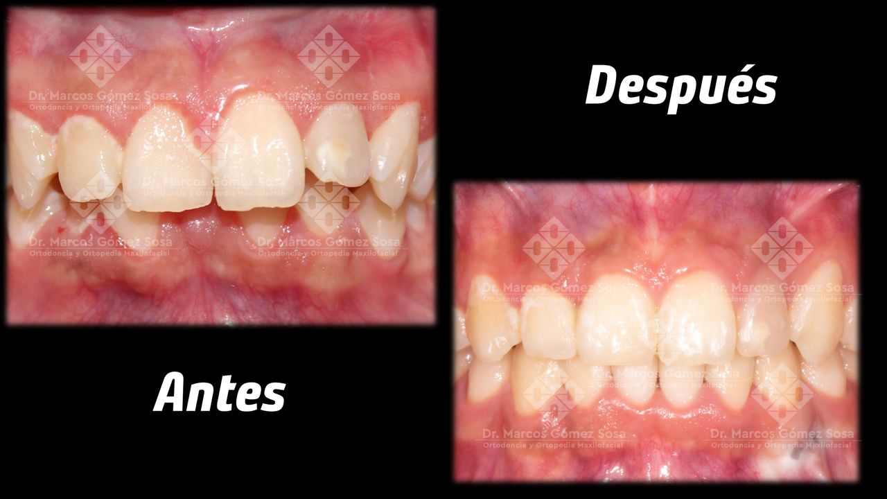 Marcos Gómez Sosa-15