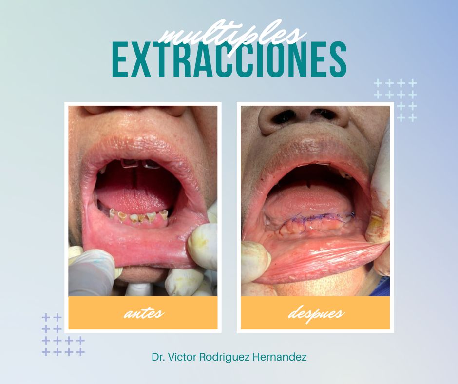 Victor Ramón Rodríguez Hernández-3