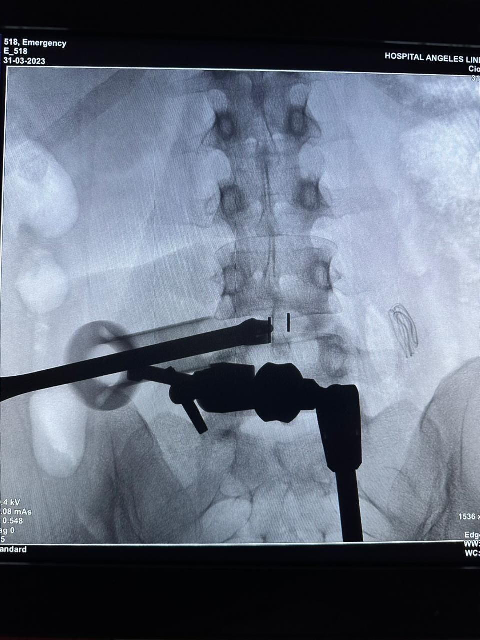 Gerson Reyes Rodríguez-32