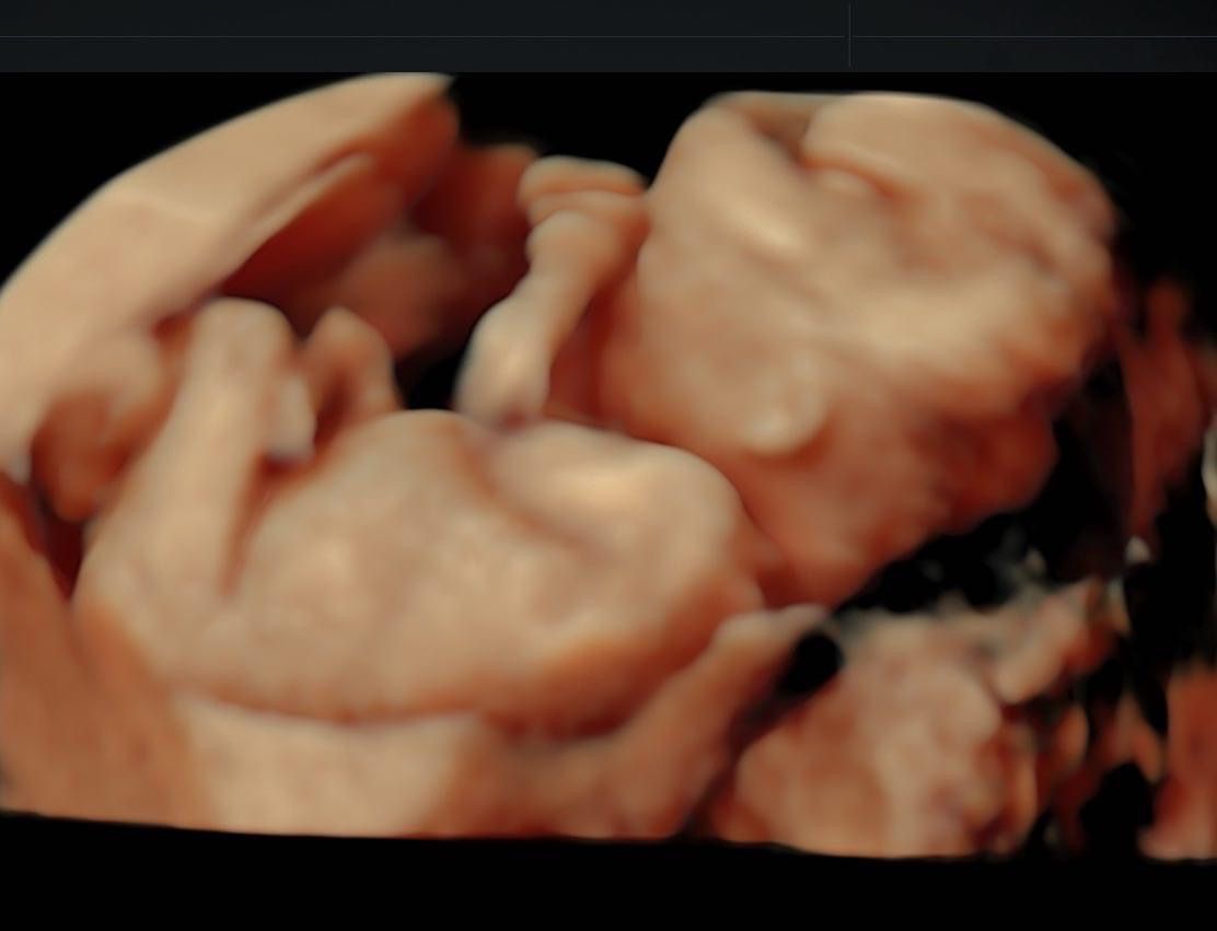 Omar Valderrama Loyola-5