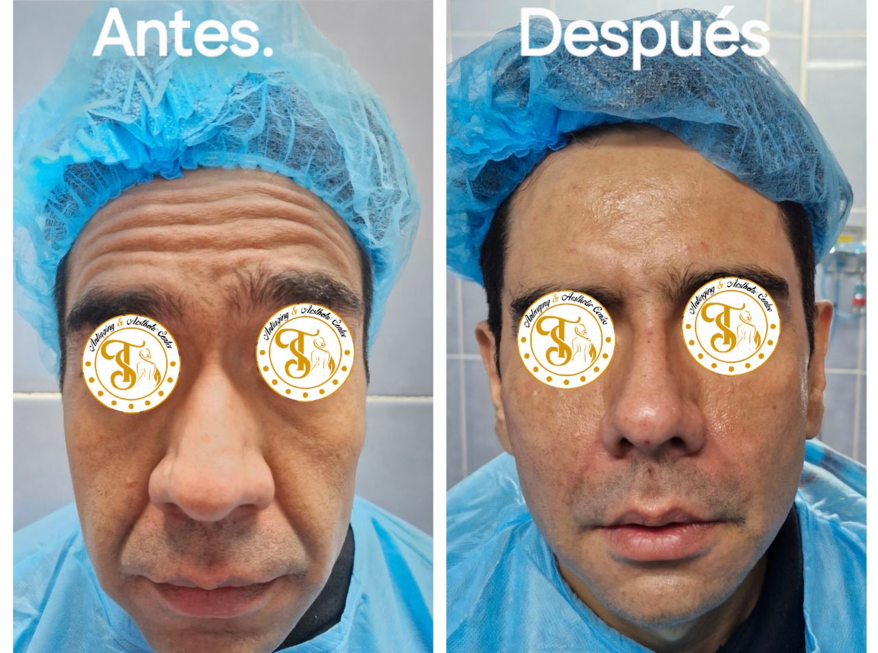 Samuel Torres Torres-11