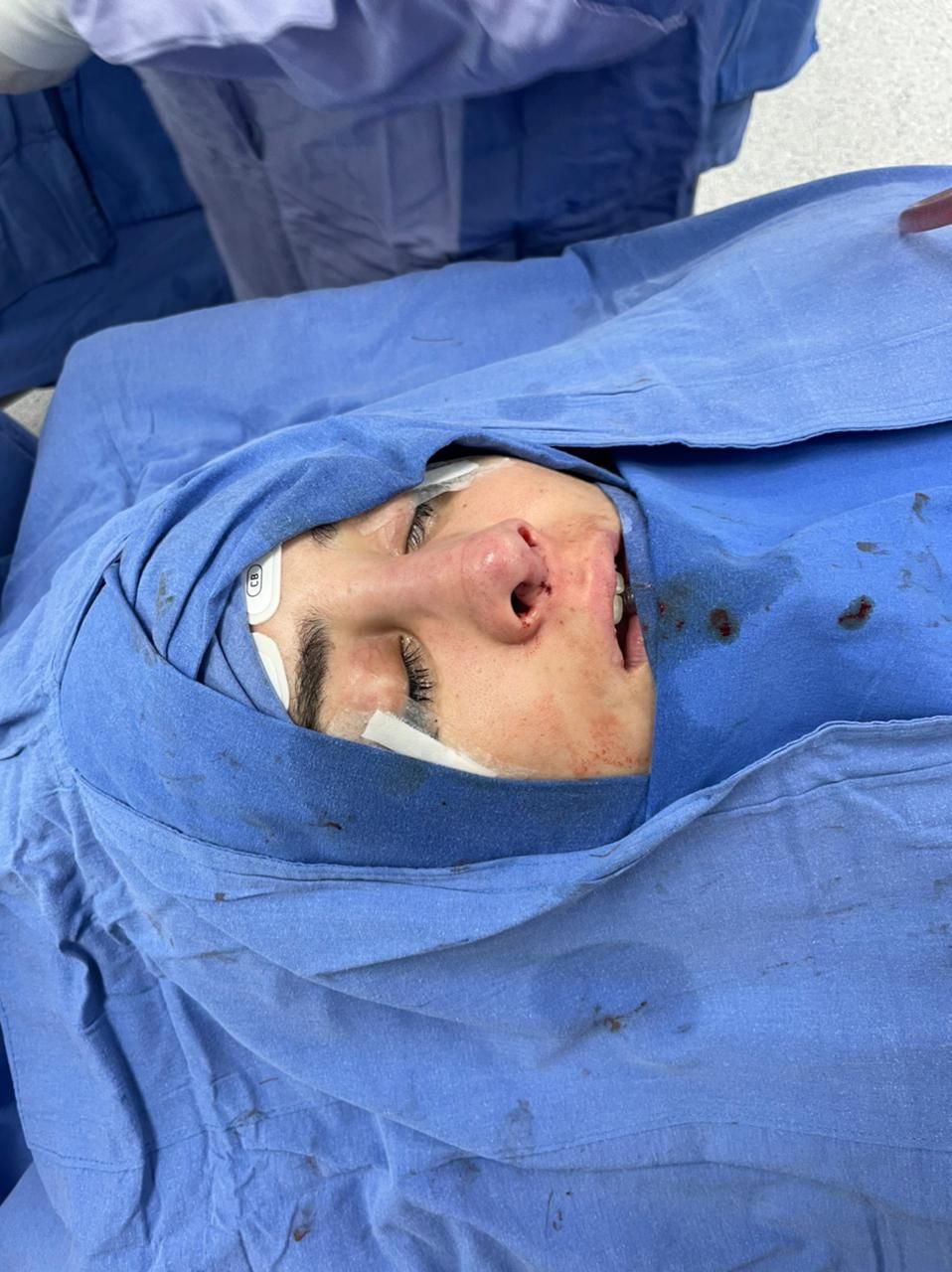 Oscar Hernandez Bautista-3