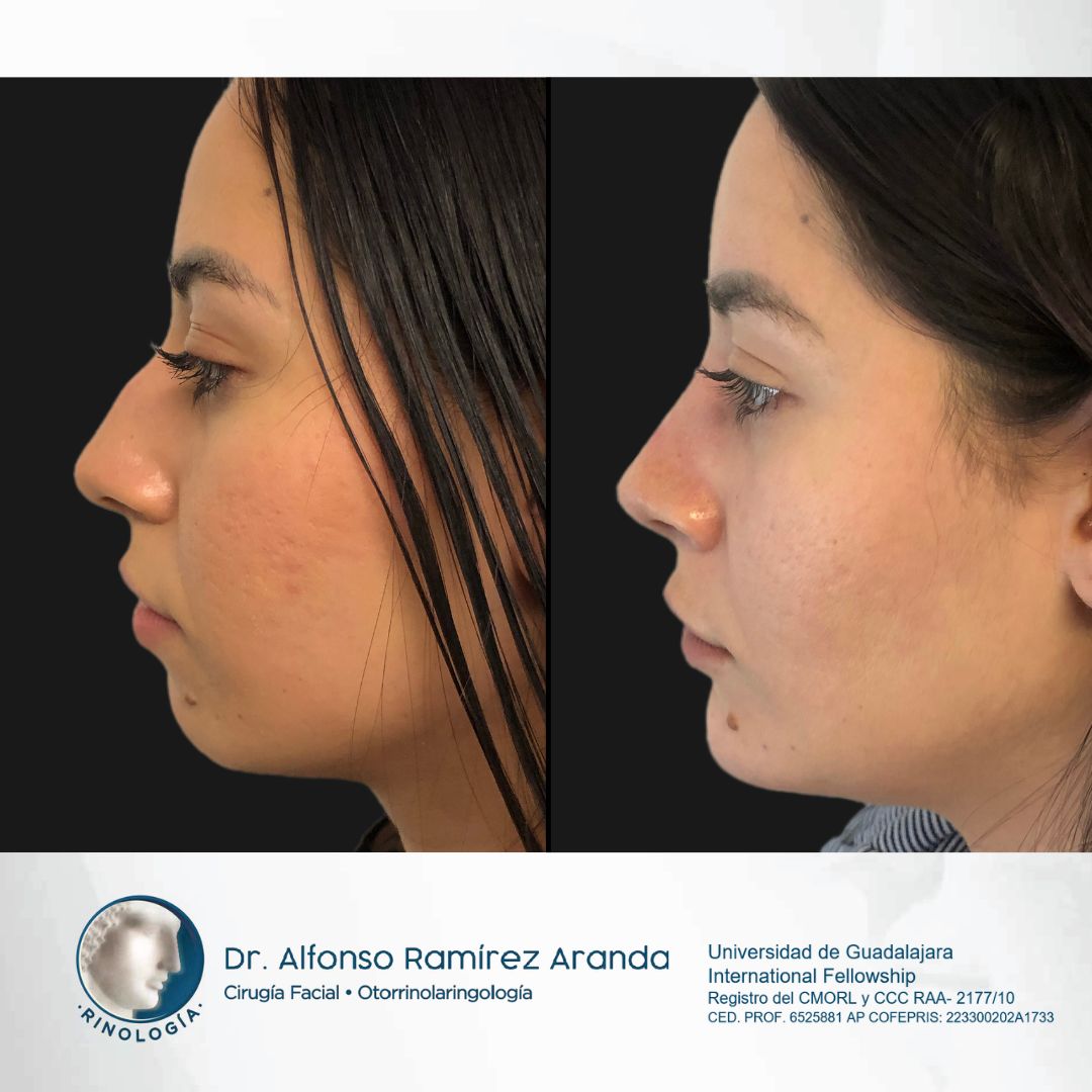 Alfonso Ramírez Aranda-32