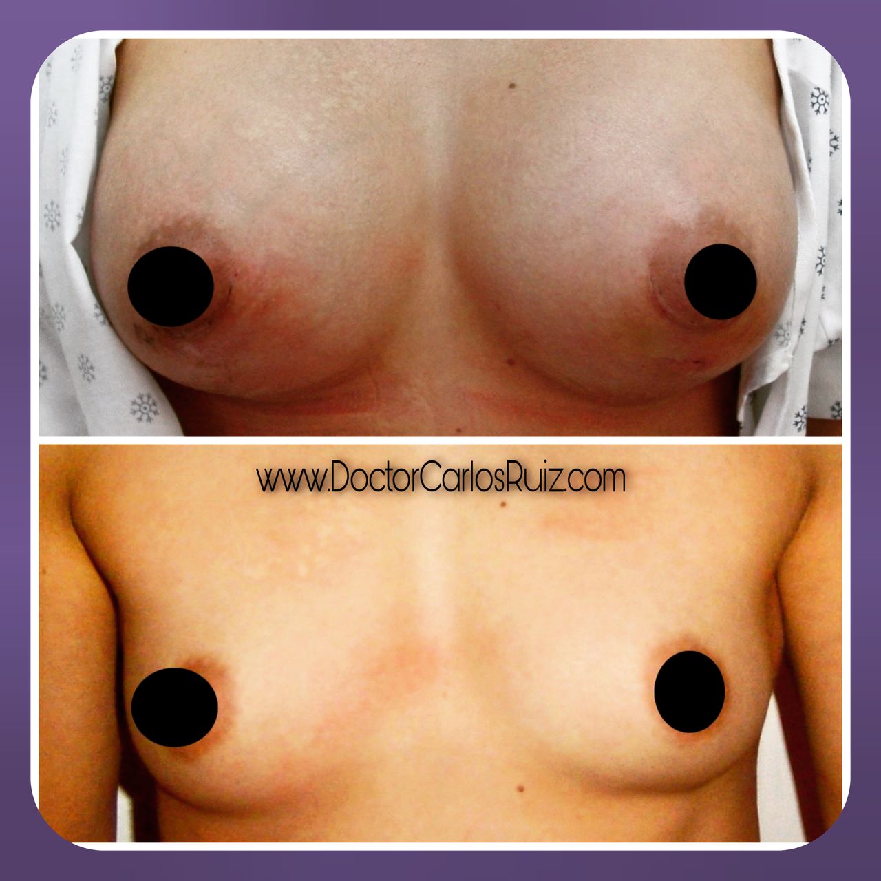 Carlos Alberto Ruiz Zepeda-6