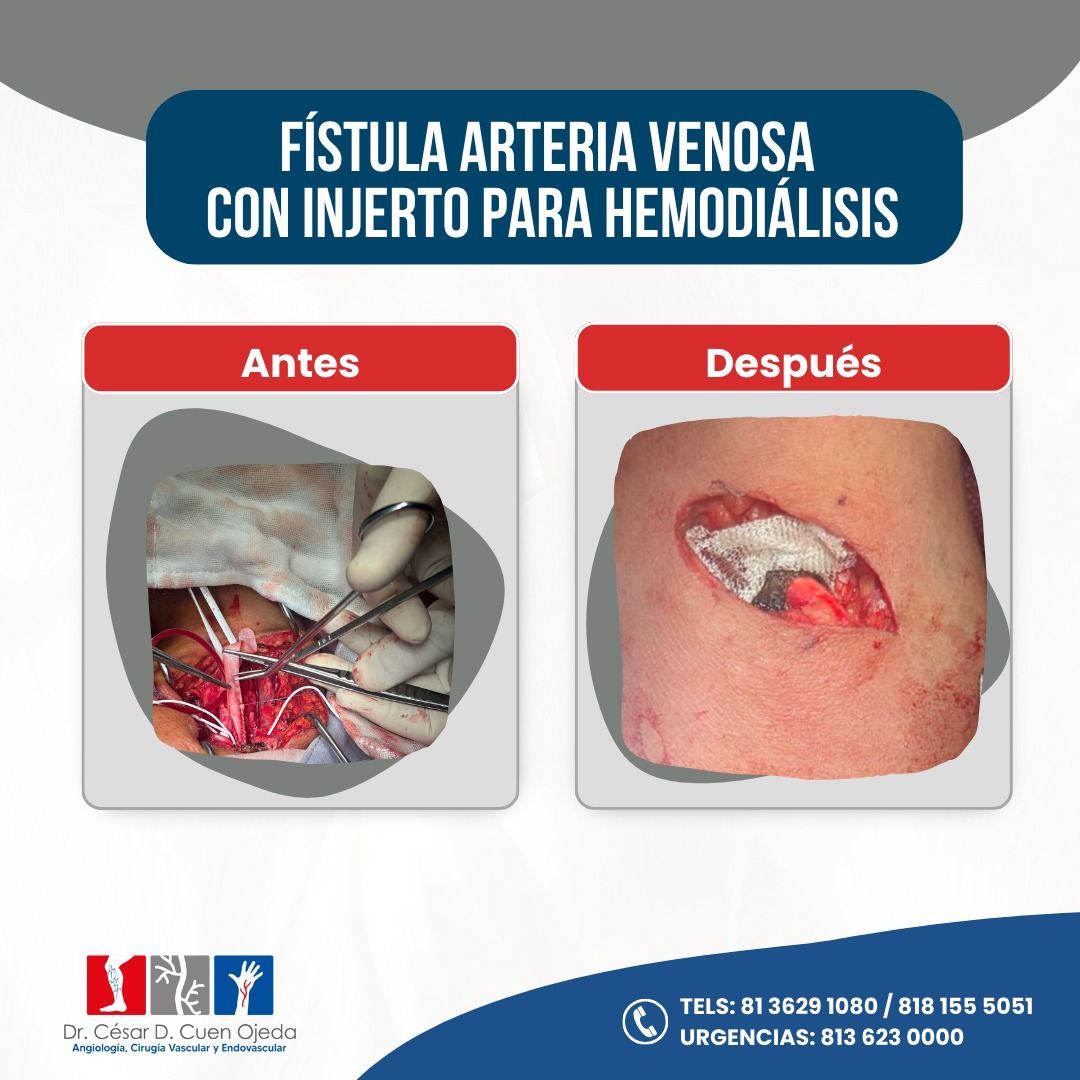 César Daniel Cuen Ojeda-11