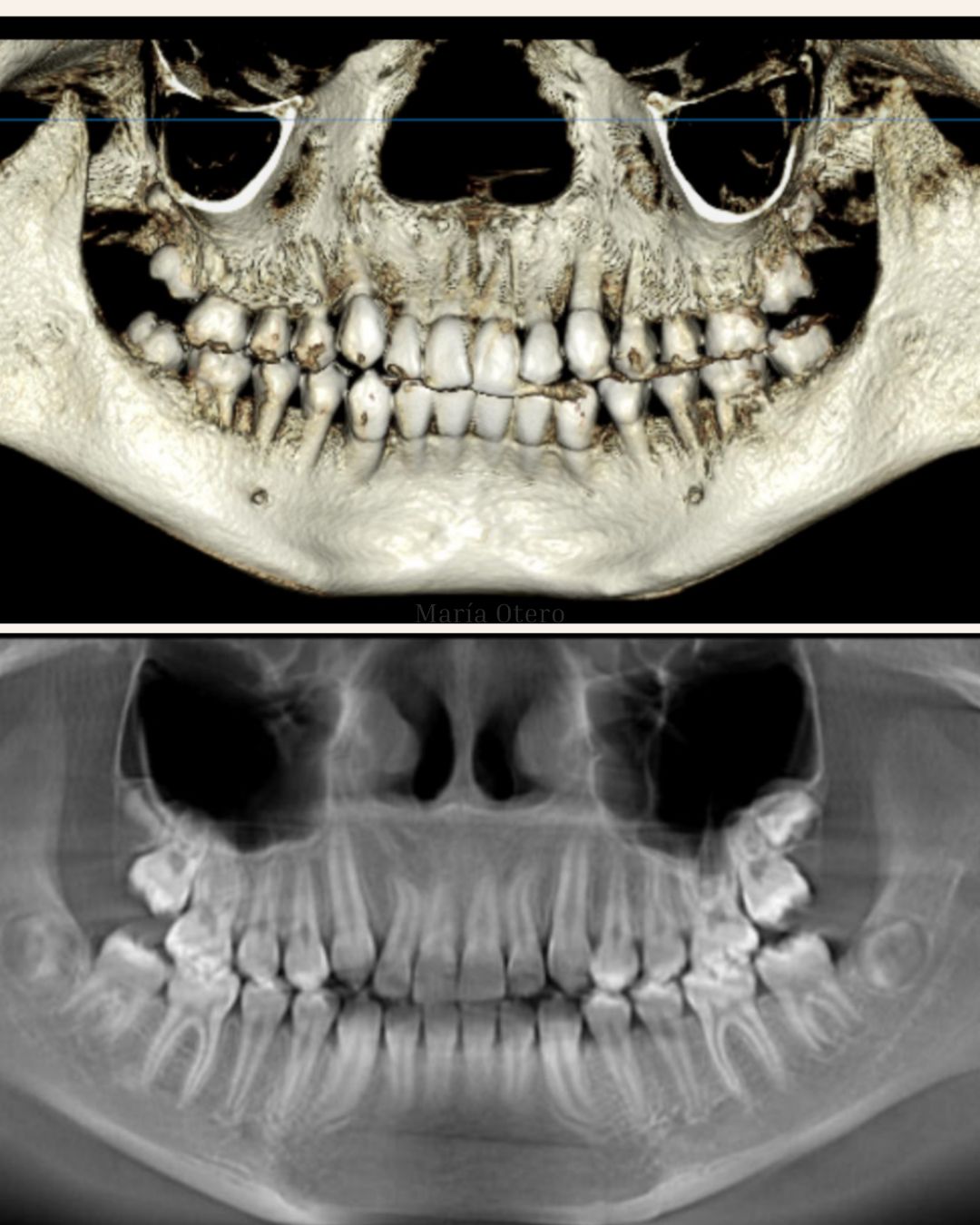 Maria Jesus Otero Lois-16