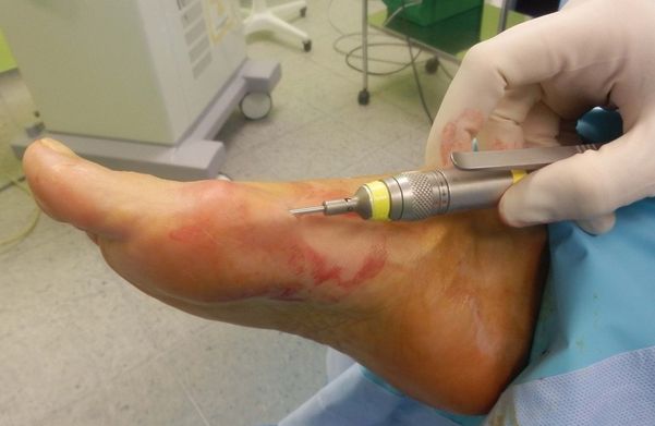 Luis Fernando Juárez Hartleven-0