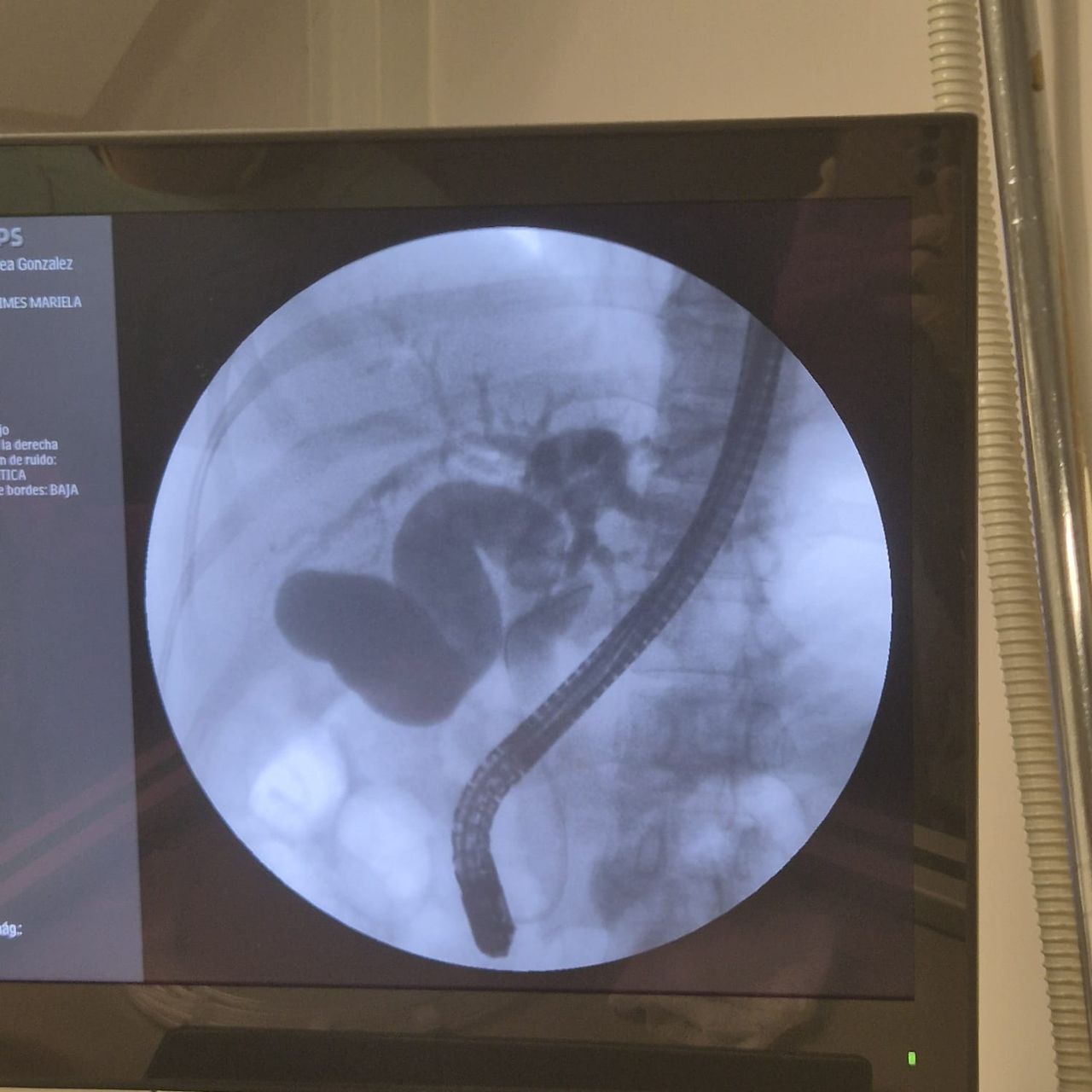 Christopher Josafat Toranzo Gonzalez-10