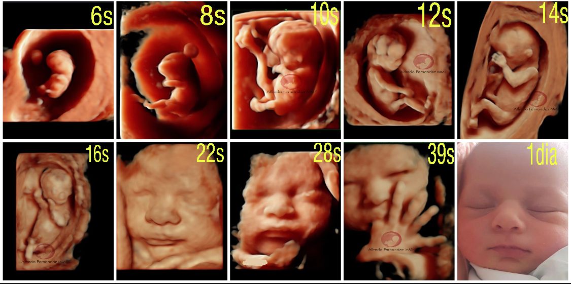 Alfredo Fernández-6