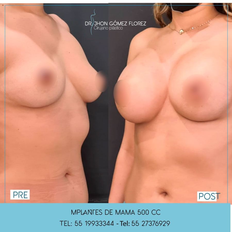 Jhon César Gómez Florez-20