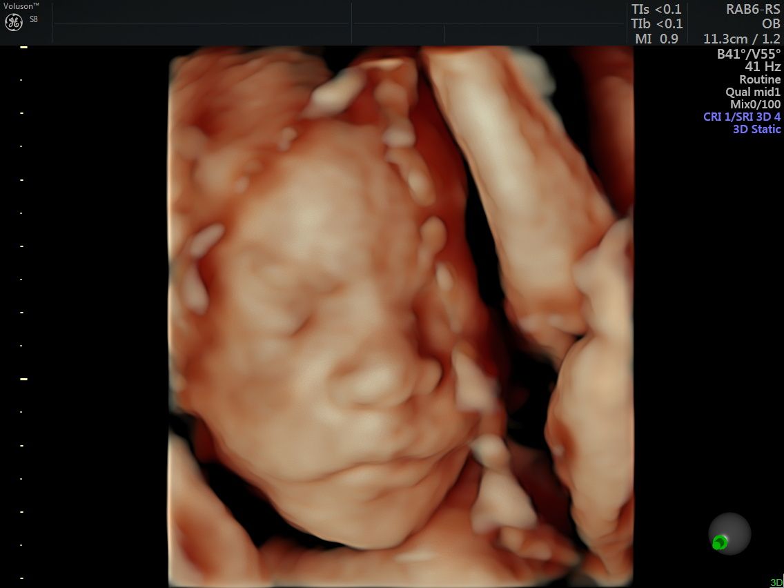 Griselda Reyes Torres-19