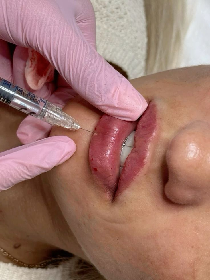 Miguel Angel Aguirre-8