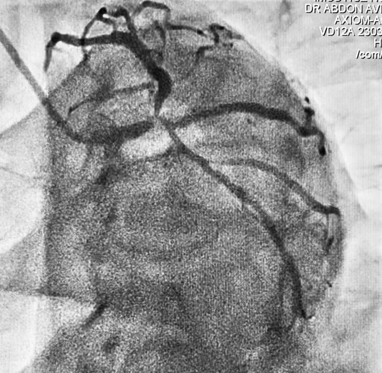 Abdón Ávila Chávez-6
