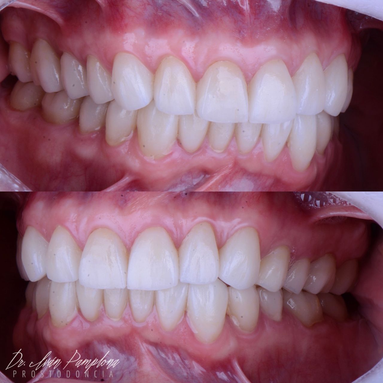 Iván Gerardo Pamplona Alfaro-3