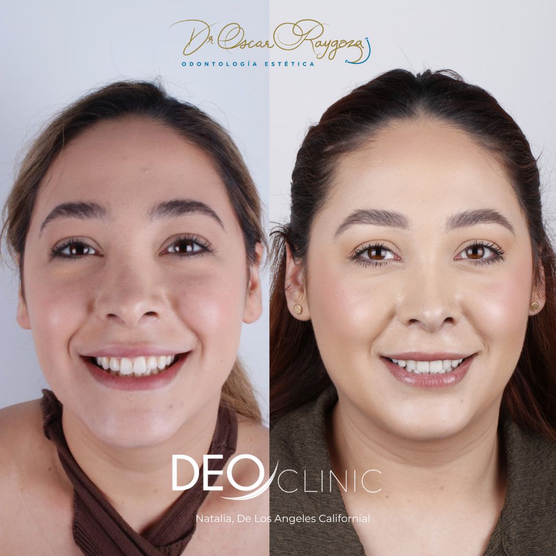 Oscar Raygoza Carrillo-56