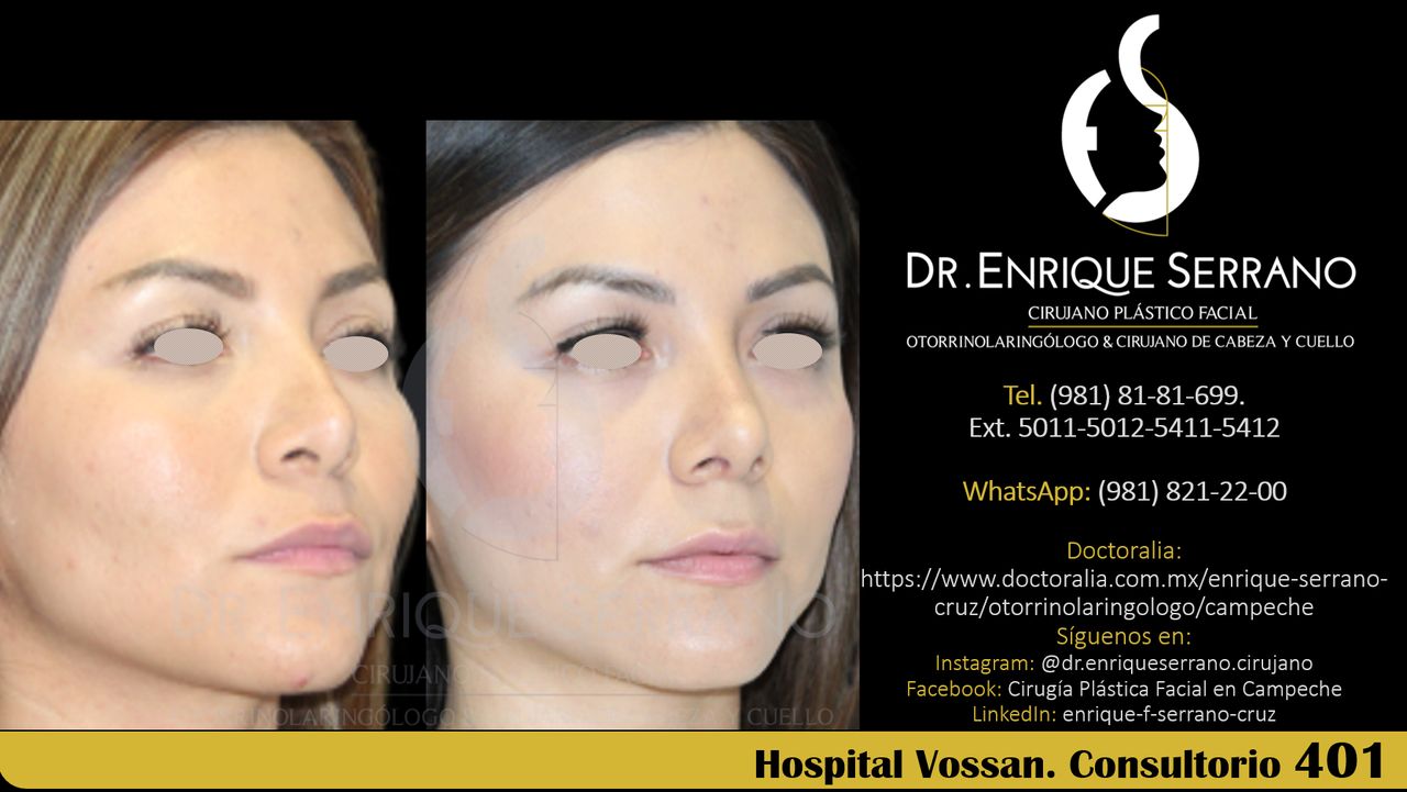 Enrique Serrano Cruz-108