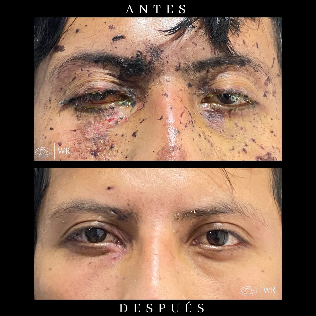 Wolfgang Rebollo Ramírez-17