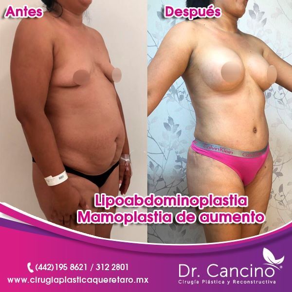 Luis M. R. Cancino-33