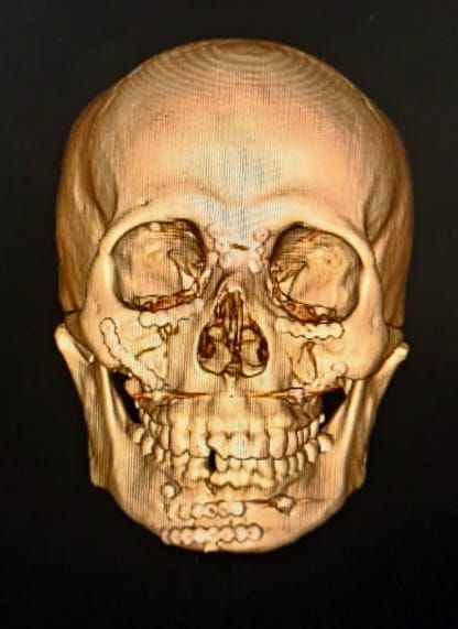 Francisco Emir Islas Zambrano-0