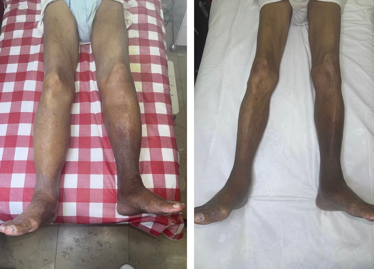 Jhonatan López González-77