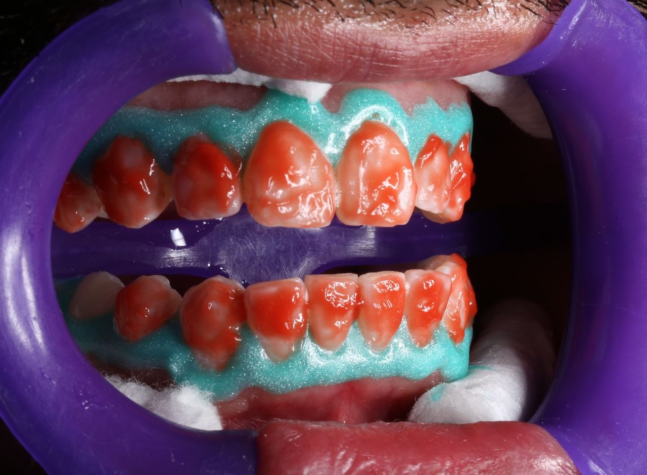 Oscar Alejandro Azcárate Tendilla-1