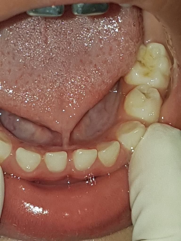 Zeyda Oliman Hoyos-1