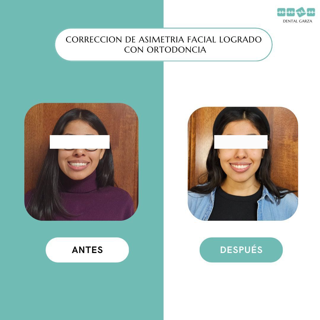 Lisette Garza Ponce-4