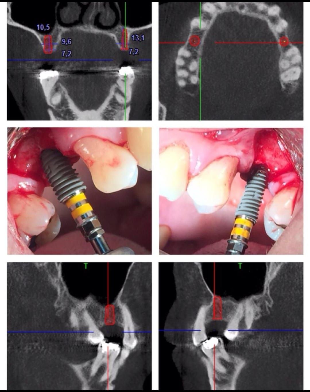 Carlos Ernesto Contreras Castellanos-25