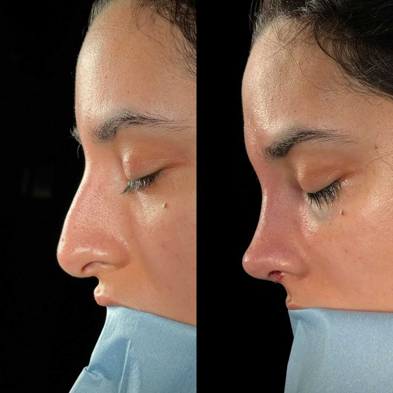 Angel Castro Urquizo-103