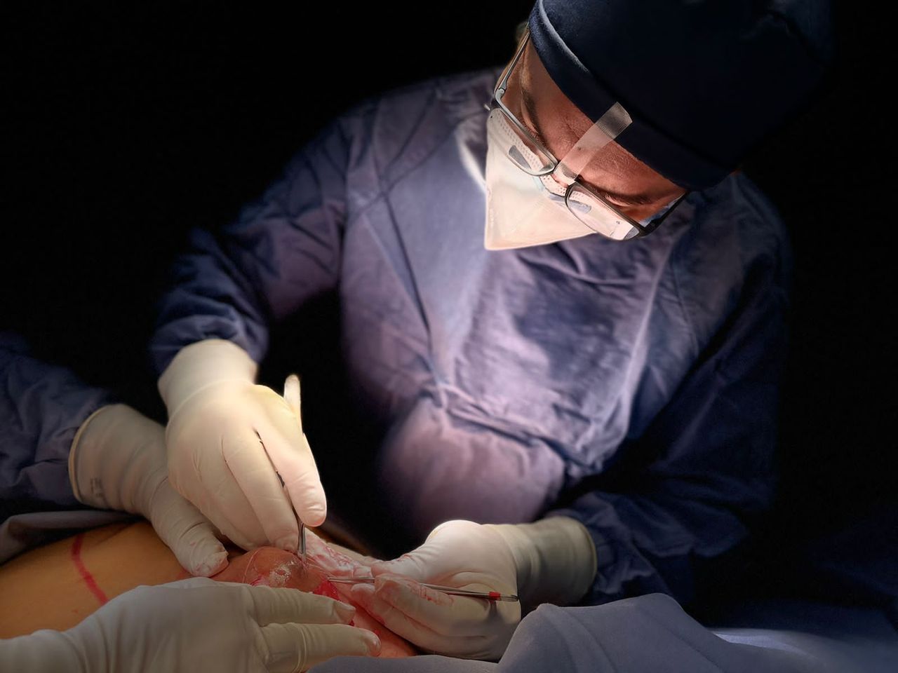 Carlos Alberto Ruiz Zepeda-30