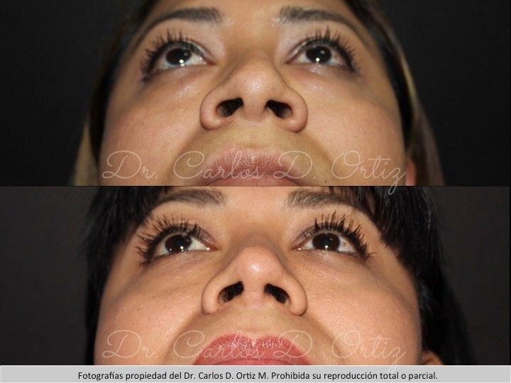 Carlos David Ortiz Moreno-20